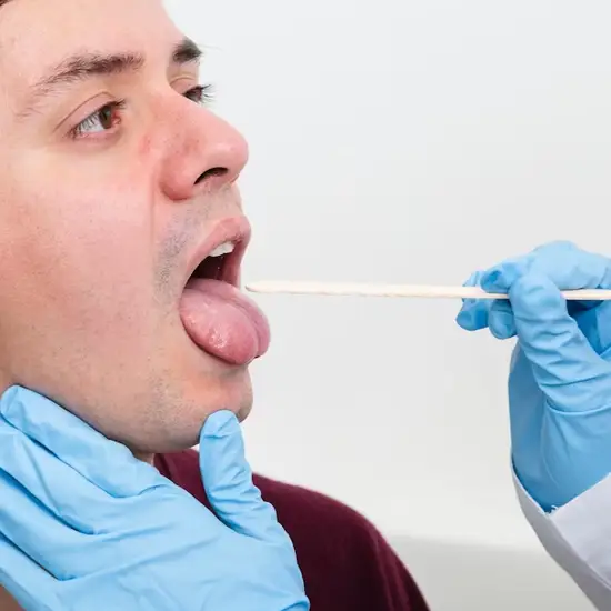 throat swab culture test
